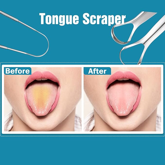 Tongue Scraper